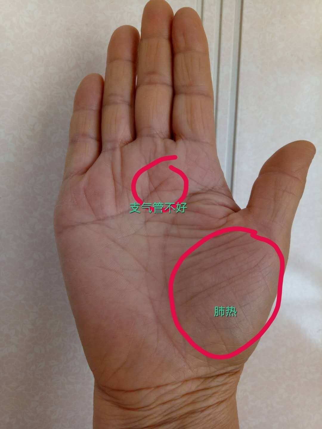 （李向东）手中罕见的手纹分别有不同的指向？