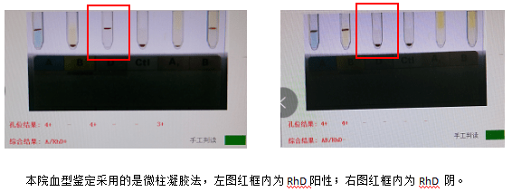 整套解决方案
:【科普】深度揭秘熊猫血——Rh血型