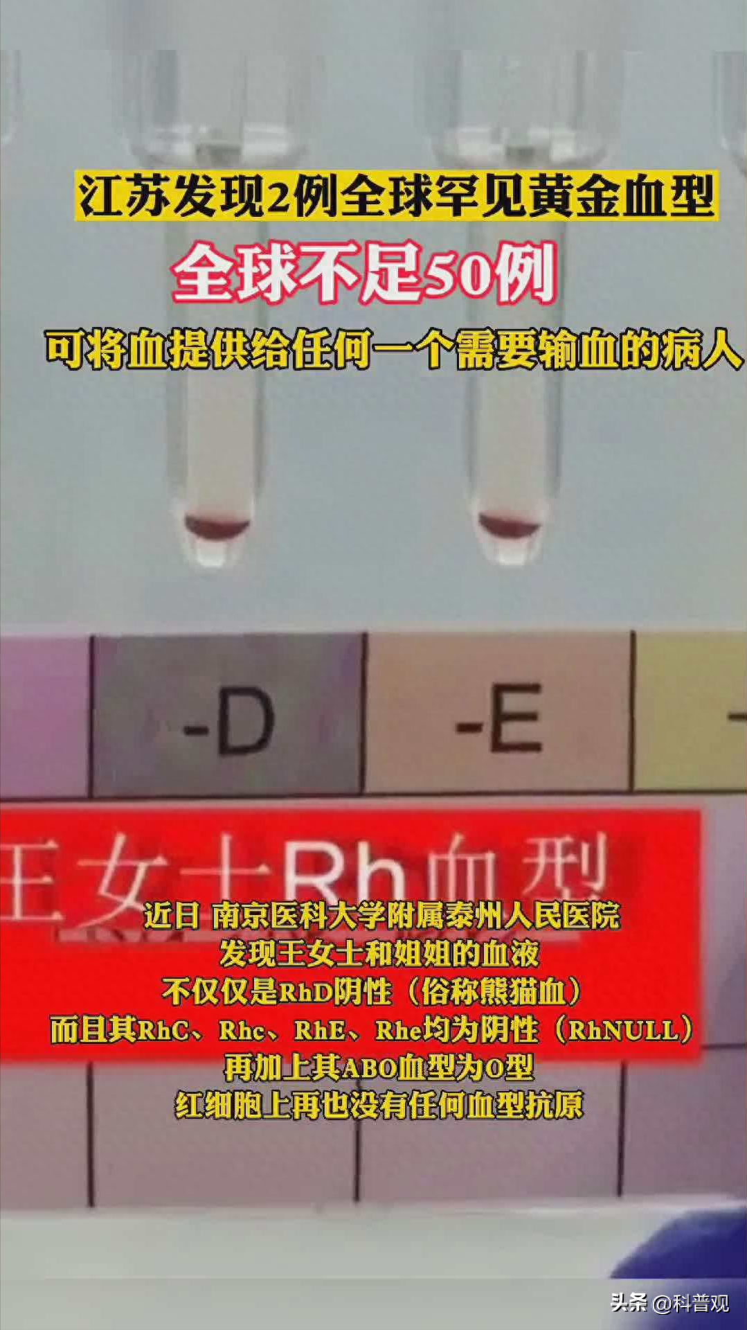 工作反思
:全球不足50例？江苏发现2例罕见黄金血型，比熊猫血更珍贵