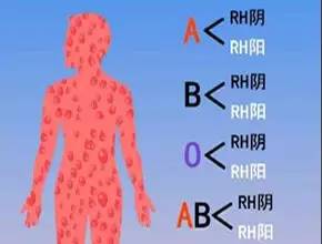 工作反思
:拥有“熊猫血”是一种怎样的体验