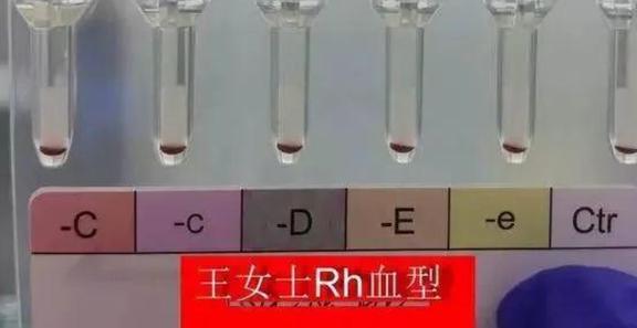 比“熊猫血”还珍贵的血型，万能黄金血，对拥有者而言却是灾难？