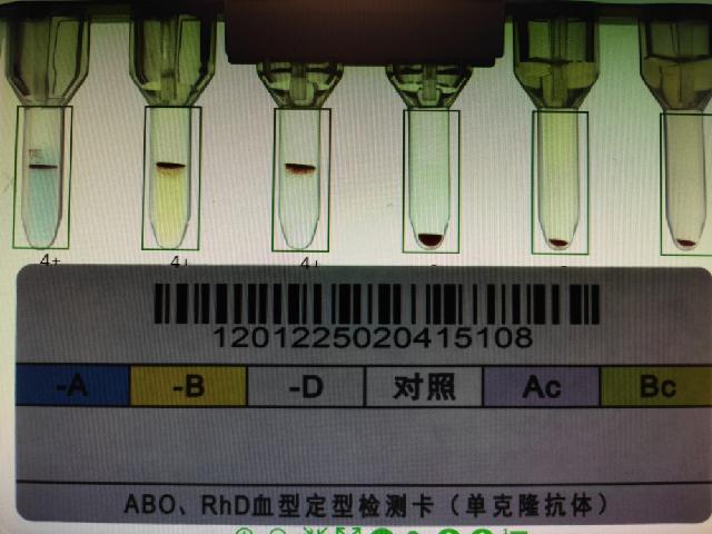 这种血型比“熊猫血”更罕见！关于血型的那些真相你必须知道