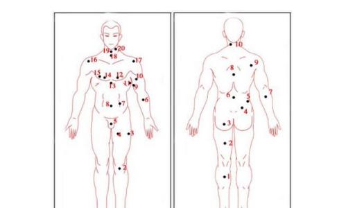 身上痣相图解大全 全身痣图解大全